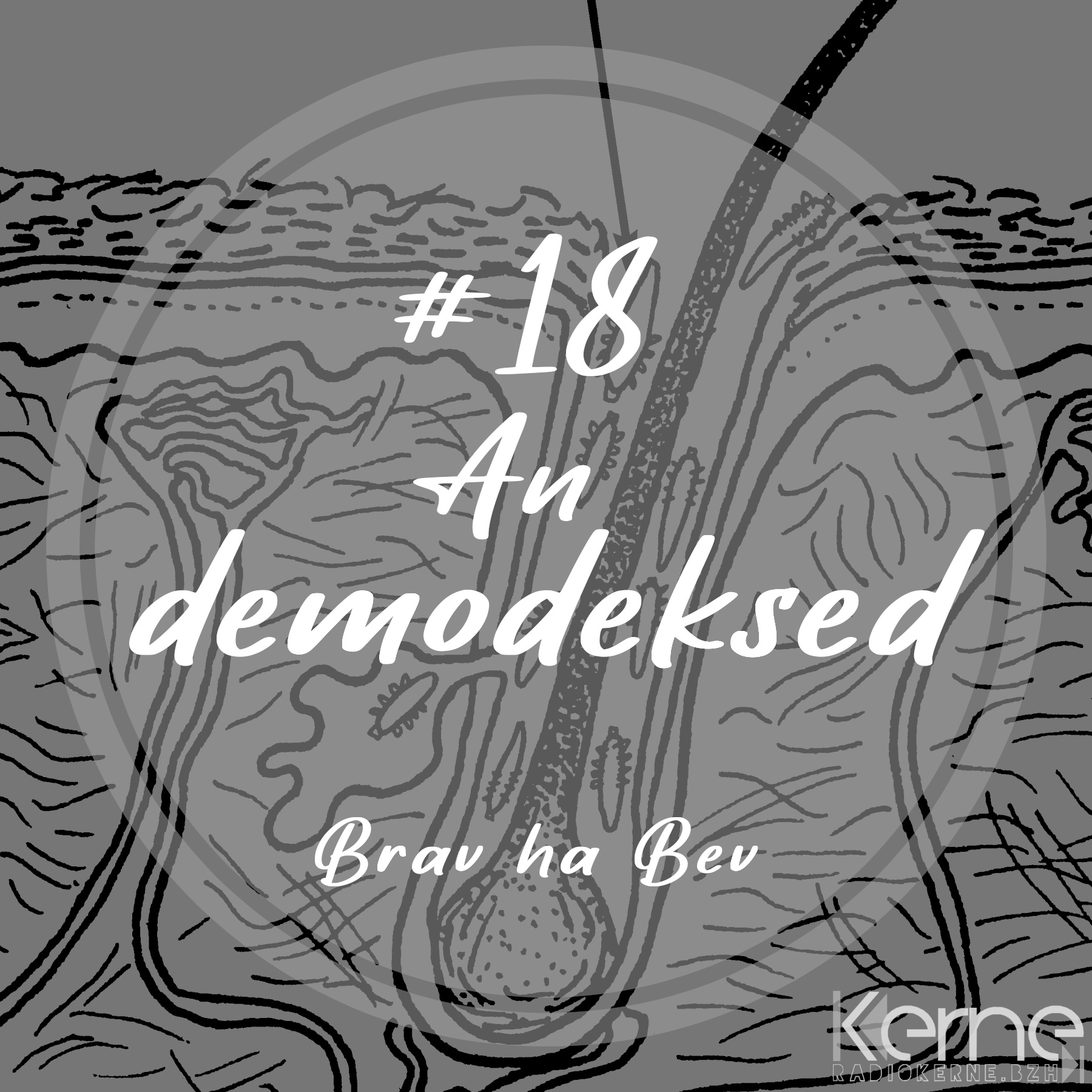 #18 An demodeksed