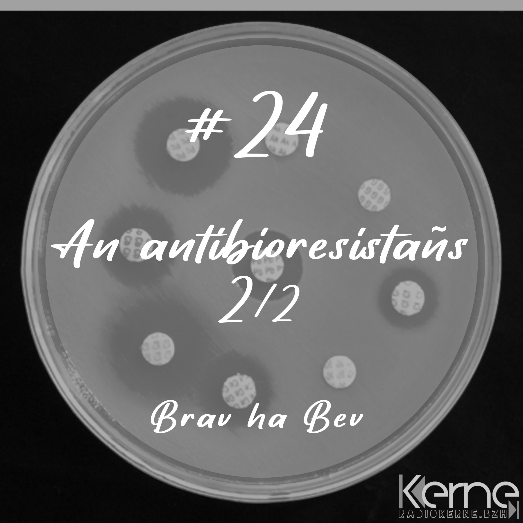#24 An antibioresistañs (2/2)